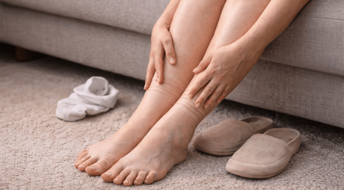 Podle oteklých nohou poznáte špatnou lymfu.