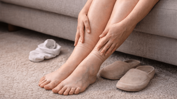 Podle oteklých nohou poznáte špatnou lymfu.