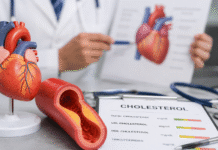 Vysoký cholesterol může mít špatný dopad na zdraví.