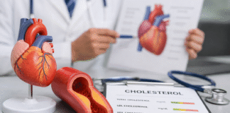 Vysoký cholesterol může mít špatný dopad na zdraví.