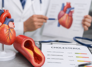 Vysoký cholesterol může mít špatný dopad na zdraví.