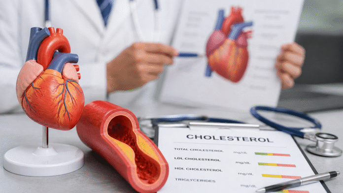 Cholesterol Vysoký cholesterol může mít špatný dopad na zdraví.